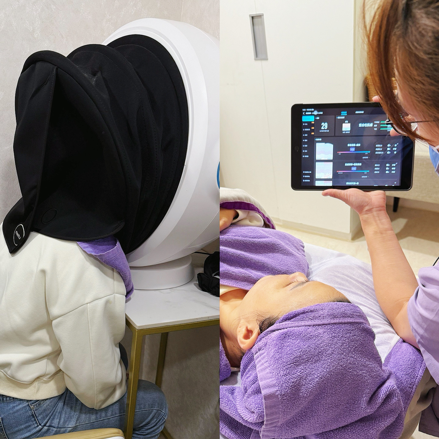 打造上鏡輪廓-愛爾麗忠孝店雙子星極線音波一試就懂 - 第4張圖 打造上鏡輪廓-愛爾麗忠孝店雙子星極線音波一試就懂