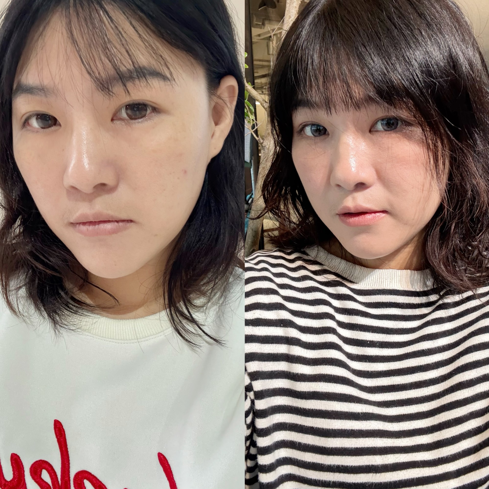 打造上鏡輪廓-愛爾麗忠孝店雙子星極線音波一試就懂 - 第8張圖 打造上鏡輪廓-愛爾麗忠孝店雙子星極線音波一試就懂